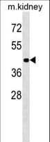 ACVR1B / ALK4 Antibody (aa39-68)