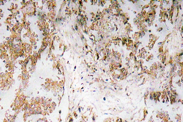 IL1A / IL-1 Alpha Antibody (Phe8)