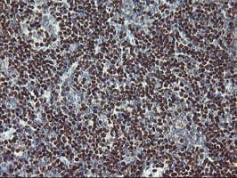 MEF2C Antibody (clone OTI1D1)