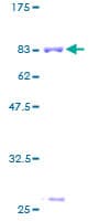Human ASL / Argininosuccinate Lyase Protein (Recombinant GST)
