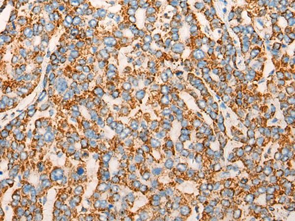 CHCHD3 Antibody