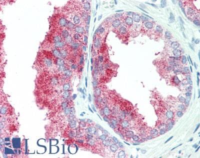 IHC-plus™ IL17RA Antibody