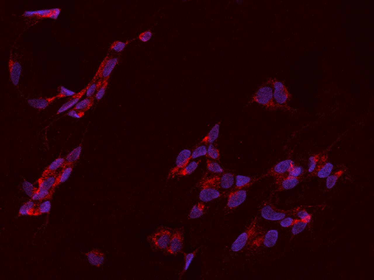 MRPS21 Antibody