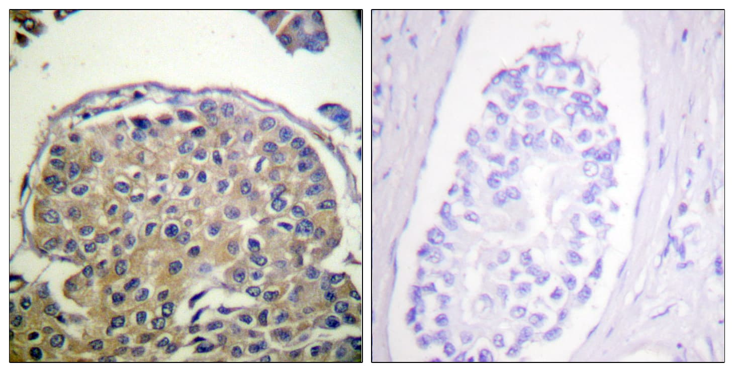 Polyclonal Rabbit anti-Human EMA / MUC1 Antibody (phospho-Tyr1243, IHC)