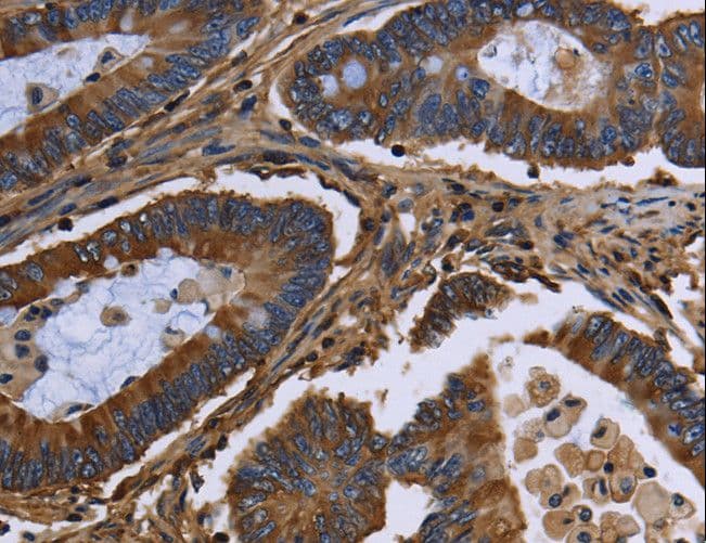 Polyclonal Rabbit anti-Human FGB / Fibrinogen Beta Chain Antibody (IHC, WB)