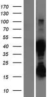 ASRGL1 Protein (Over-Expression Lysate Myc-DDK (Flag))