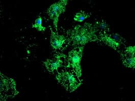 PSMB9 Antibody (aa21-219, clone OTI1D1)