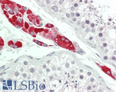 IHC-plus™ Polyclonal Rabbit anti-Human CYP17 / CYP17A1 Antibody (aa358-388, IHC, IF, WB)