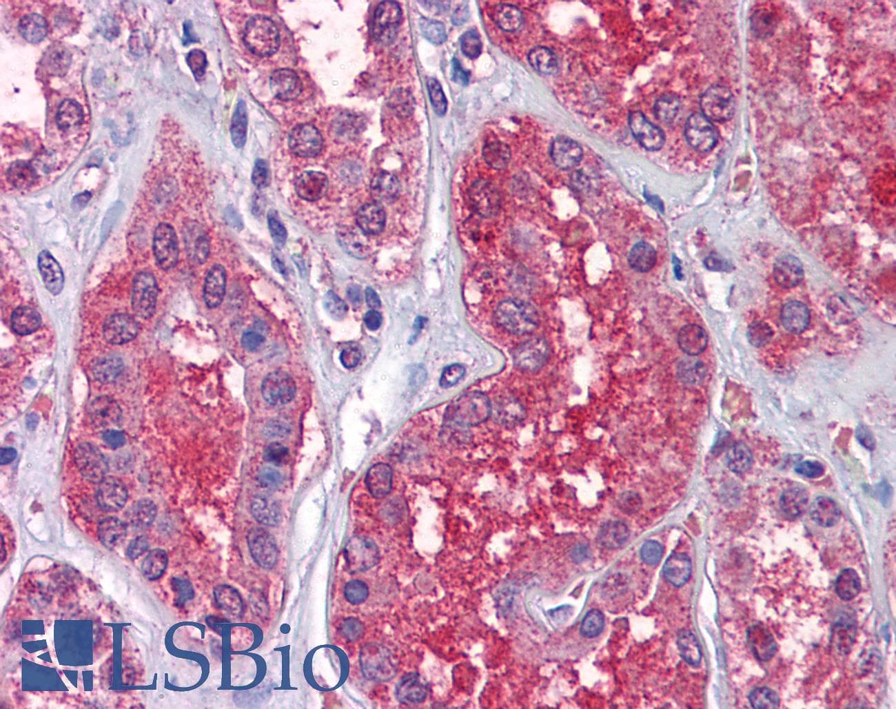 IHC-plus™ RAF1 / RAF Antibody (N-Terminus)