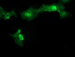 MMACHC Antibody (clone OTI1A4)