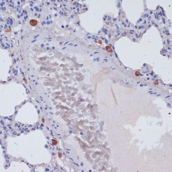 PRF1 / Perforin Antibody
