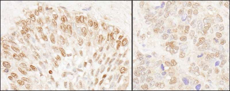 Polyclonal Rabbit anti-Human NUP50 Antibody (aa418-468, IHC, WB)