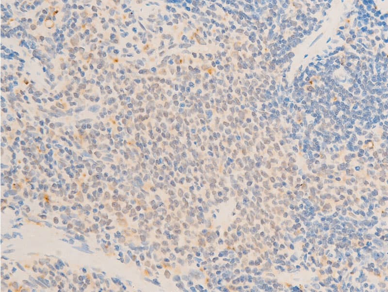 MAP3K7 / TAK1 Antibody (phospho-Thr187)