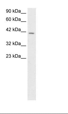 SMAD3 Antibody (N-Terminus)