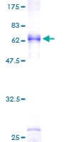 Human TRA2B / SFRS10 Protein (Recombinant GST)