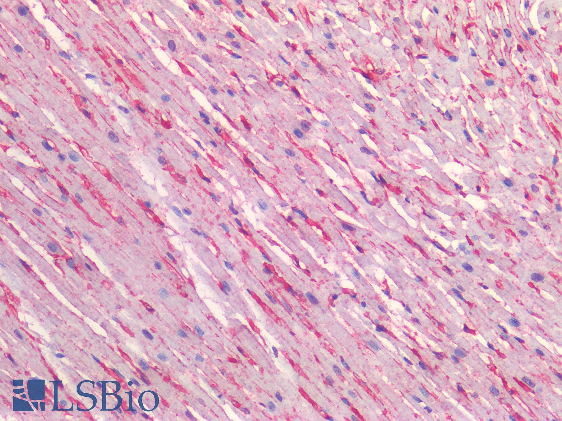 PathPlus™ CAV1 / Caveolin 1 Antibody (N-Terminus)