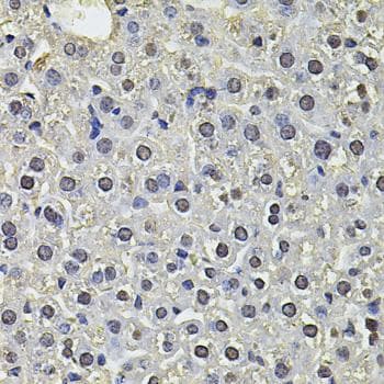 Polyclonal Rabbit anti-Human SP110 Antibody (IHC)