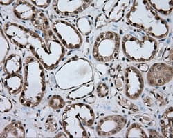 Monoclonal Mouse anti-Human NME4 Antibody (clone OTI1H1, IHC, IF, WB)