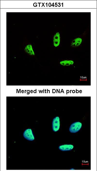 Polyclonal Rabbit anti-Human LDB1 / CLIM2 Antibody (aa86-411, IHC, WB)
