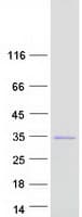 Human UNC119B Protein (Recombinant Myc-DDK (Flag))