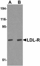 LDLR / LDL Receptor Antibody