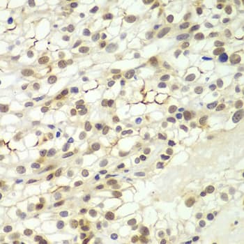 LHX4 Antibody
