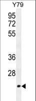 IHC-plus™ TCEAL3 Antibody (aa15-43)