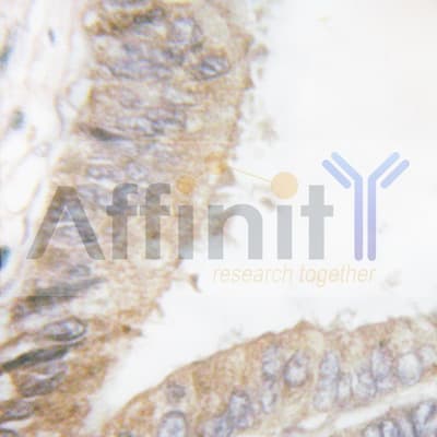 Polyclonal Rabbit anti-Human PAK1 Antibody (IHC, IF, WB)