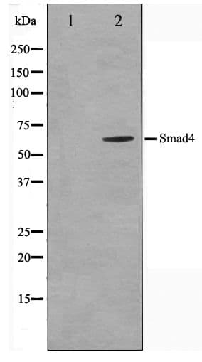 Polyclonal Rabbit anti-Human SMAD4 Antibody (WB)