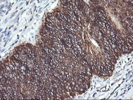 ACAA2 Antibody (clone OTI1B1)