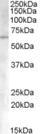 PathPlus™ ALK2 / ACVR1 Antibody (aa147-161)