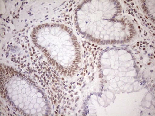 Monoclonal Mouse anti-Human MGMT Antibody (clone OTI2F10, IHC, WB)