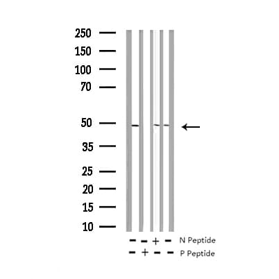 HDAC8 Antibody (phospho-Ser39)