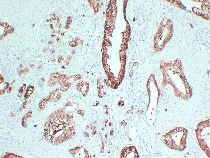 S100P Antibody (clone ABT-S100P)