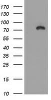 CTNNB1 / Beta Catenin Antibody (clone OTI2F6)