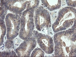 CDKN2B / p15 INK4b Antibody (clone OTI3B6)