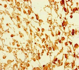 Polyclonal Rabbit anti-Human GATA6 Antibody (IHC)