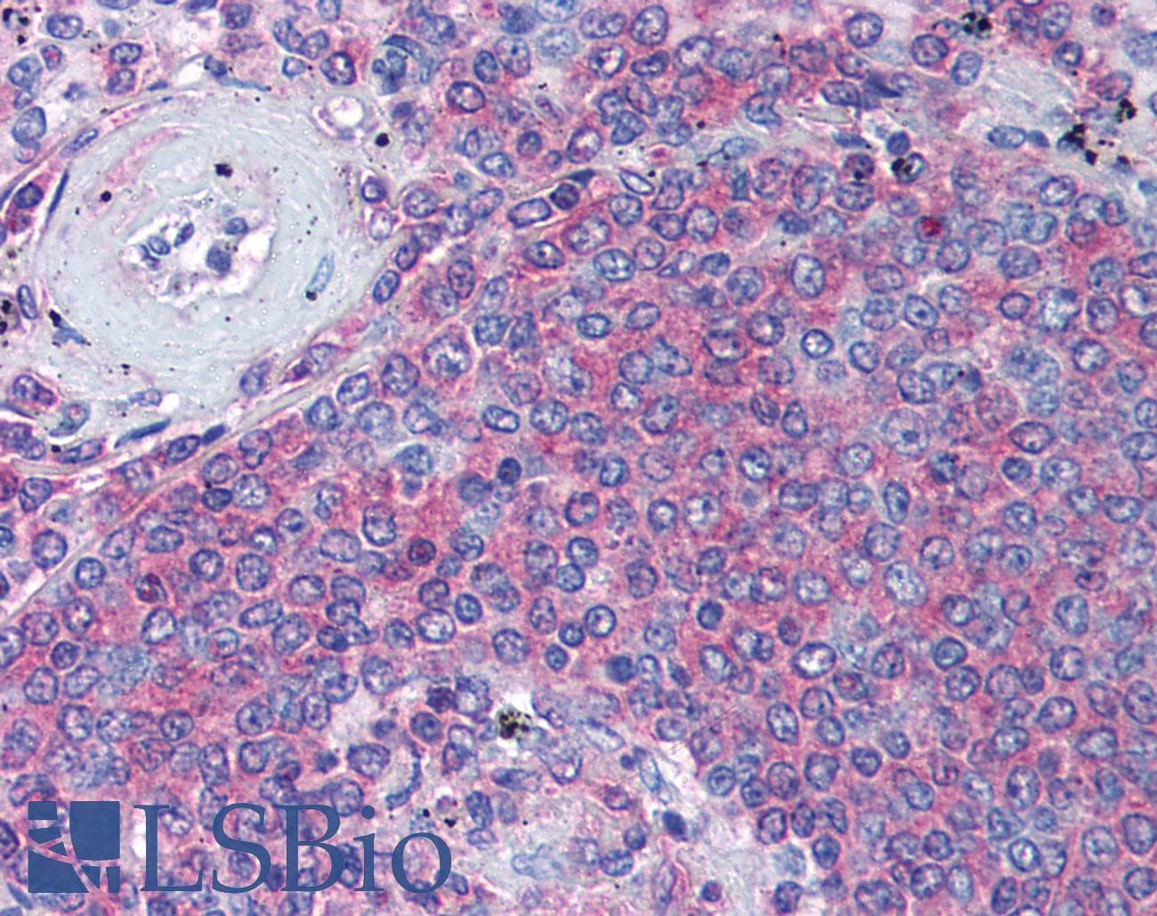 IHC-plus™ Polyclonal Rabbit anti-Human IKBKE / IKKI / IKKE Antibody (IHC, WB)