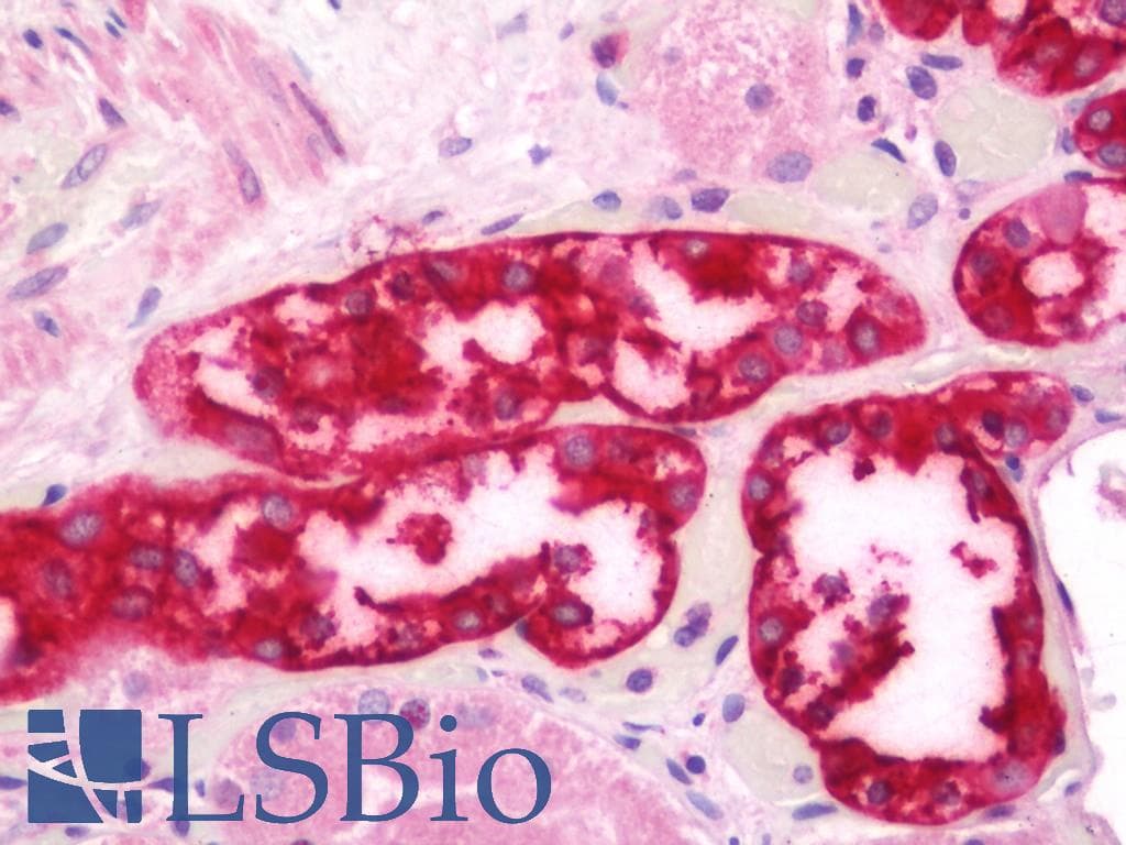 IHC-plus™ Polyclonal Rabbit anti-Human CARD14 Antibody (aa291-340, IHC, IF)