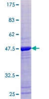 Human TPRKB Protein (Recombinant GST)
