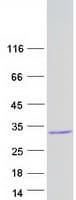 Human C6orf62 Protein (Recombinant Myc-DDK (Flag))