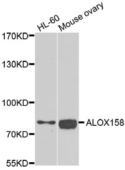 ALOX15B / 15-LOX-2 Antibody