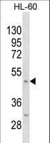 Polyclonal Rabbit anti-Mouse KCNJ11 / Kir6.2 Antibody (aa1-27, WB)