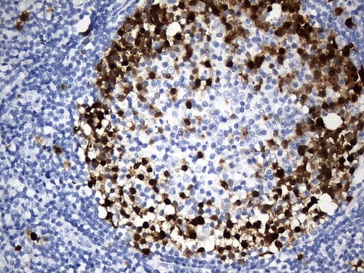 TS / Thymidylate Synthase Antibody (clone UMAB227, Carrier-free)