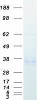 Human ACP5 / TRAP Protein (Recombinant Myc-DDK (Flag))