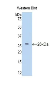 GC / Vitamin D-Binding Protein Antibody (aa205-403, PE)
