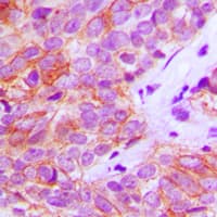 FGFR3 Antibody (Internal)