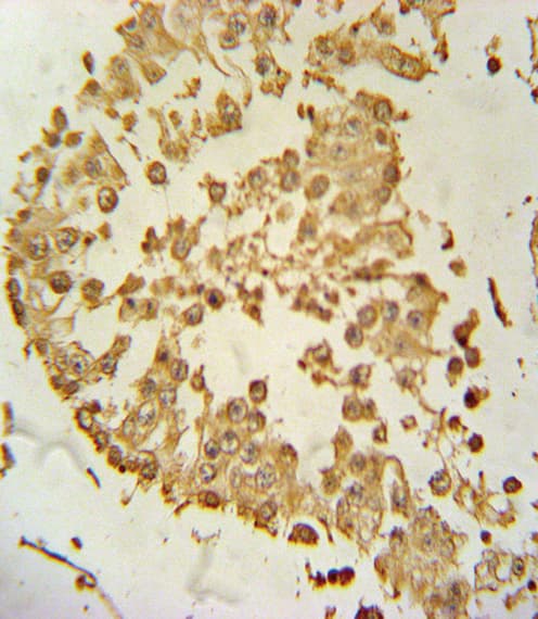 Polyclonal Rabbit anti-Human ZDHHC21 Antibody (aa59-87, IHC, WB)