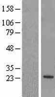 RGS5 Protein (Over-Expression Lysate Myc-DDK (Flag))
