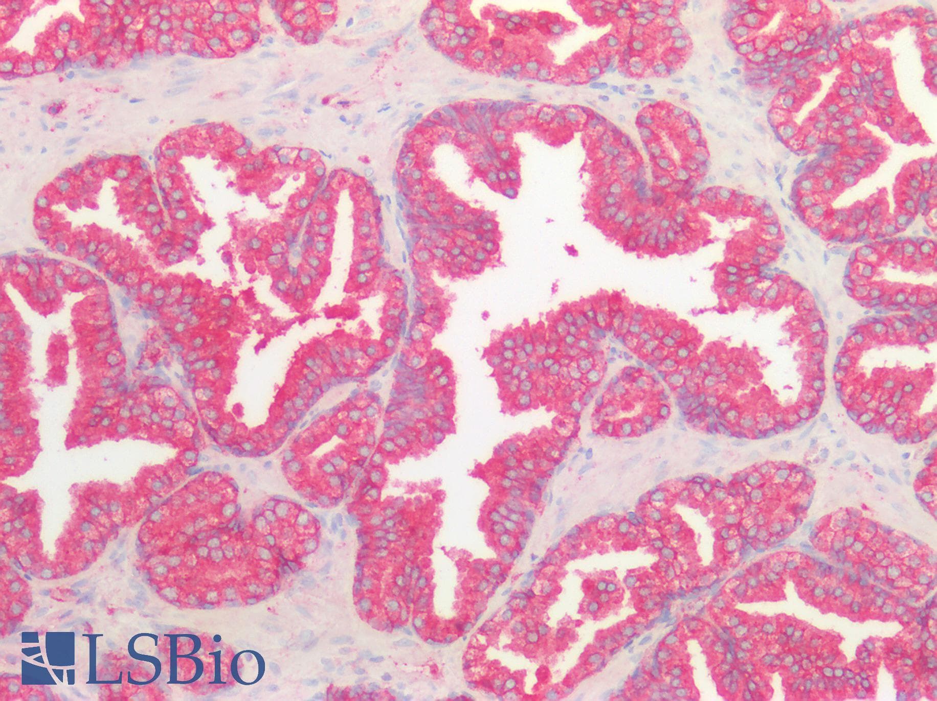 PLCL2 Antibody